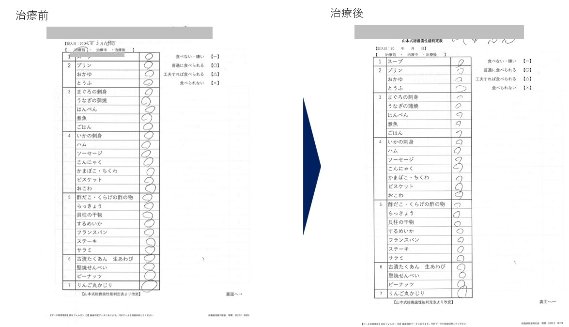 咀嚼能力判定表